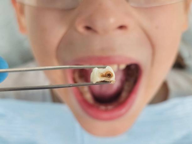 Best Weekend Emergency Dentist in Evans, GA